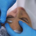 Understanding Expectations After Aesthetic Treatments in the UK